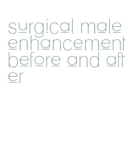 surgical male enhancement before and after