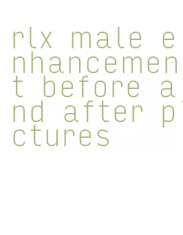 rlx male enhancement before and after pictures