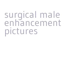 surgical male enhancement pictures