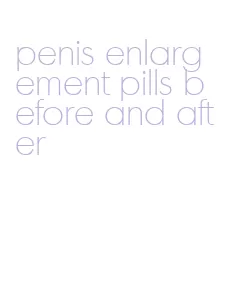 penis enlargement pills before and after